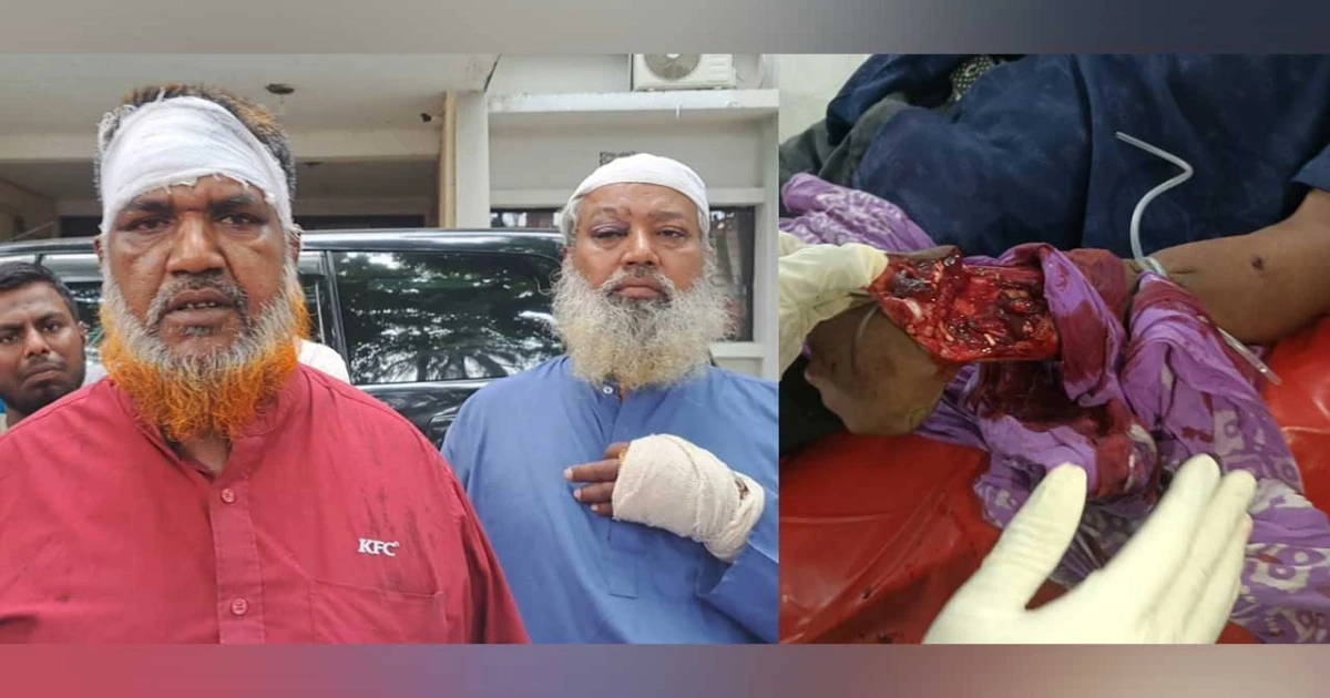 ব্রাহ্মণবাড়িয়ায় সংঘর্ষের ঘটনায় পাঁচ দিন পেরিয়ে গেলেও গ্রেপ্তার হয়নি অভিযুক্তরা