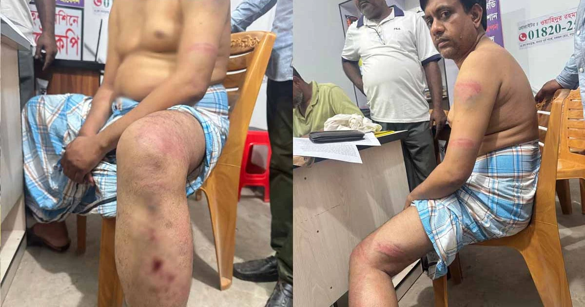 মাটি কাটায় প্রতিবাদ করায় বিএনপি নেতার ওপর হামলা, থানায় মামলা