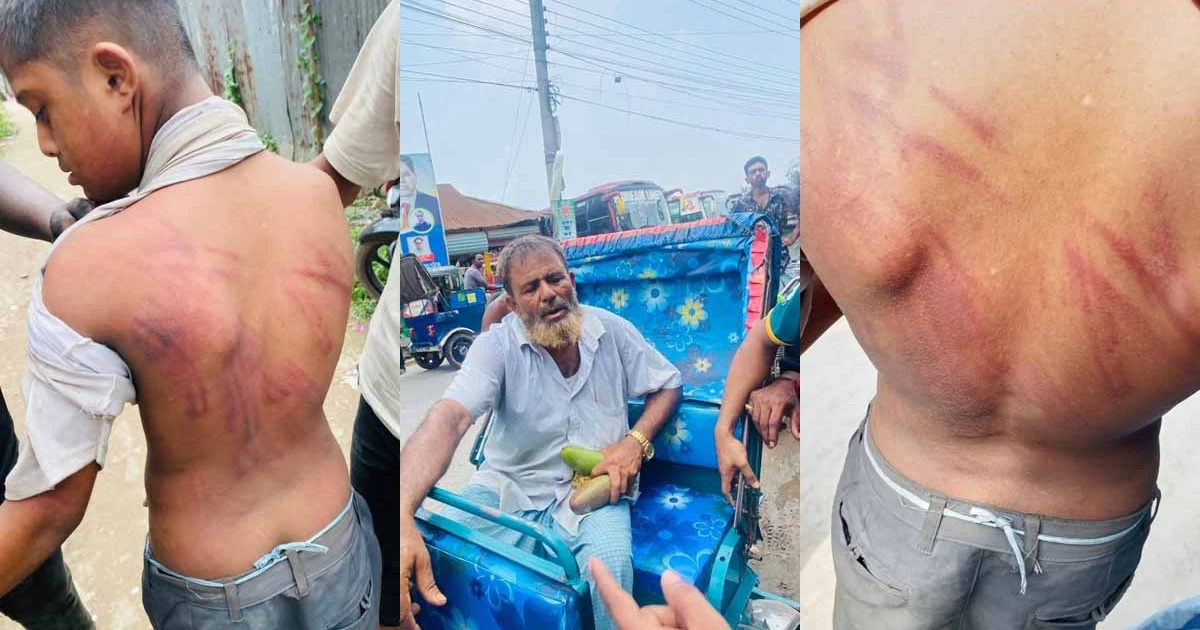 দুটি আমের জন্য শিশুকে অমানবিক নির্যাতন