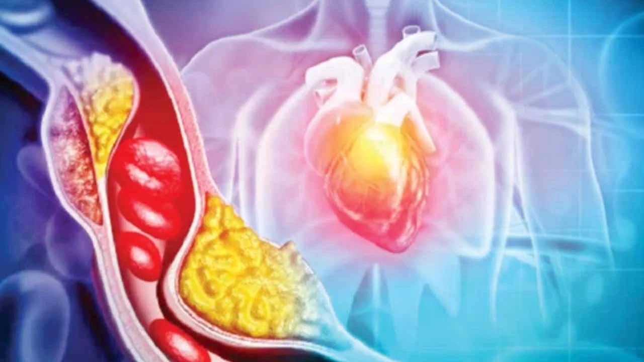 কোলেস্টেরল বেড়েছে বুঝবেন কীভাবে