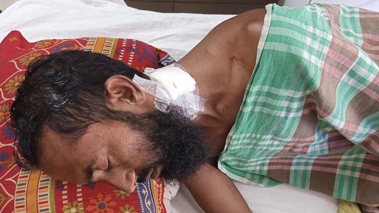 মামলায় সাক্ষী হওয়ায় মহিপুরে যুবককে কুপিয়ে জখম