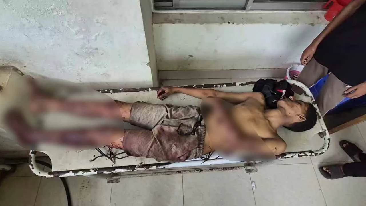 বাঞ্ছারামপুরে আধিপত্যের বিরোধে রাতভর সংঘর্ষ, নিহত ১; আহত ২৫