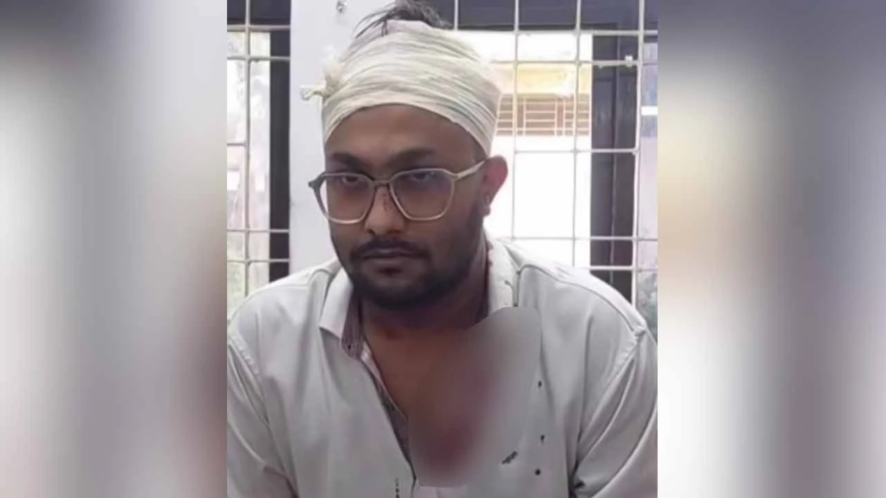টঙ্গীতে ছিনতাইকারী এবং সন্ত্রাসীর হামলায় সাংবাদিক আহত