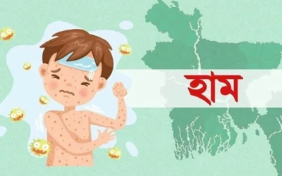 হামের উপসর্গে আরও ২ শিশুর মৃত্যু